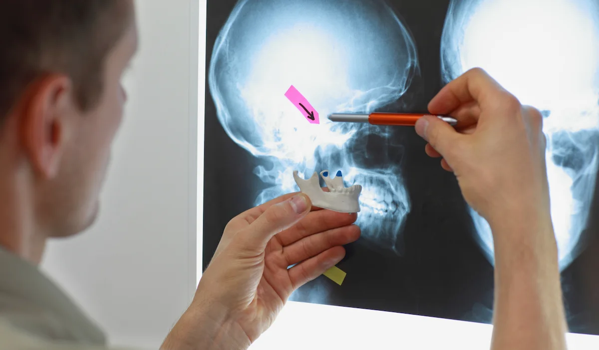Un modèle de mâchoire présenté devant une radiographie